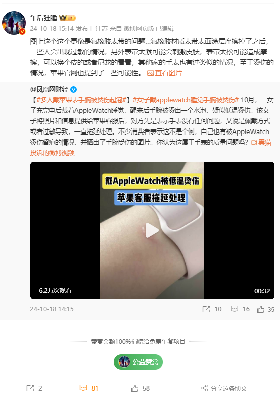 女子戴Apple Watch睡覺被燙傷起泡 蘋果客服回應：過敏反應